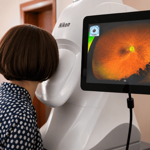 Patient on optos 1 patient on an Optos widefield imager