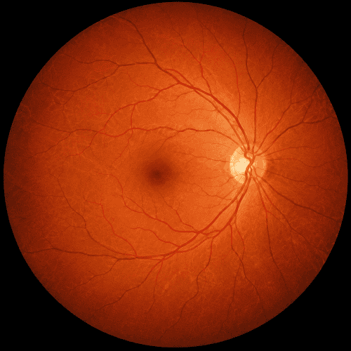 A healthy retina